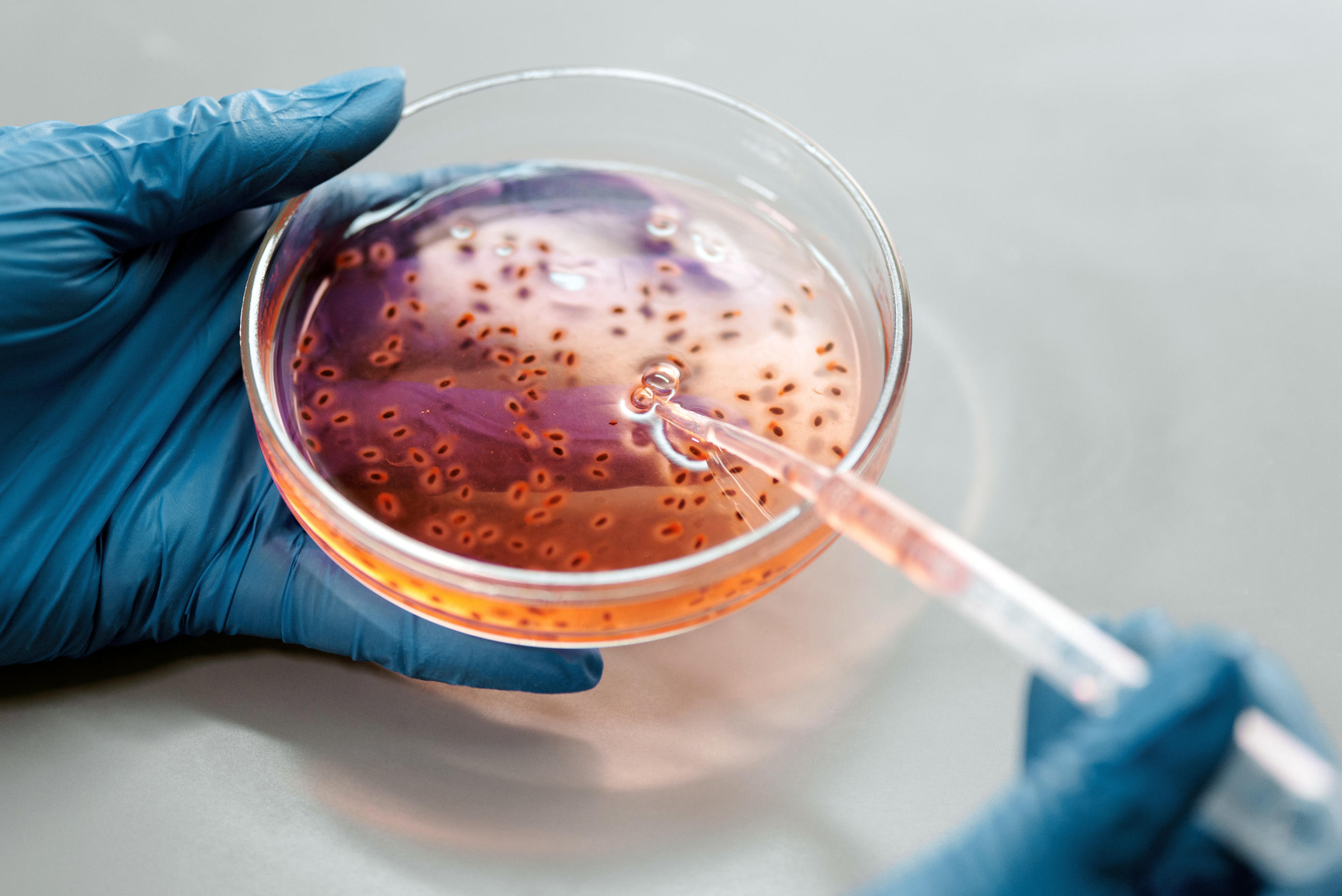Microbiologicos Análisis Microbiológicos - Conycal